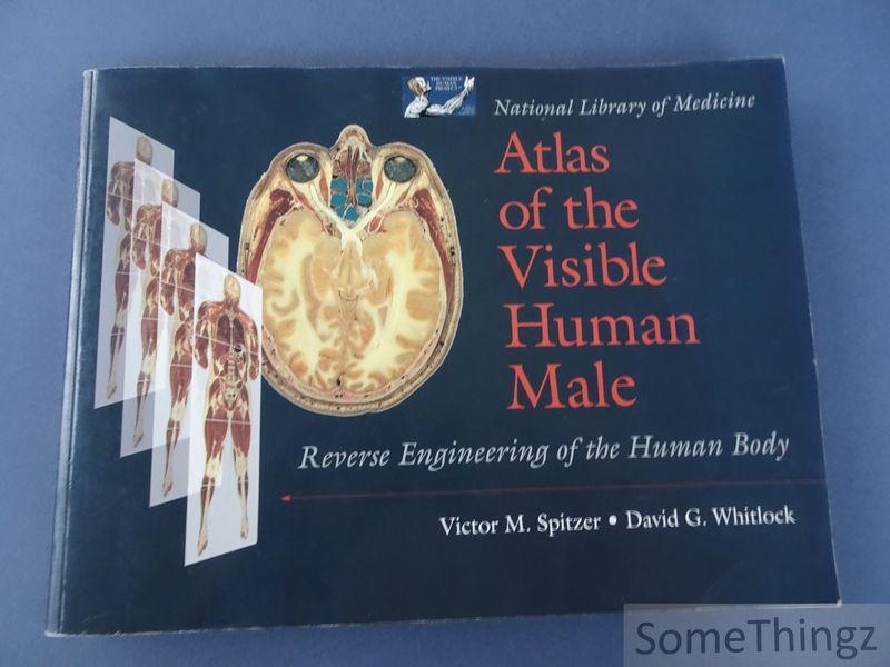 Cover van Atlas of the Visible Human Male. Reverse Engineering of the Human Body.